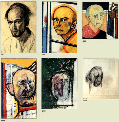 William Utermohlen - Selbstportraits in verschiedenen Stadien der Demenz